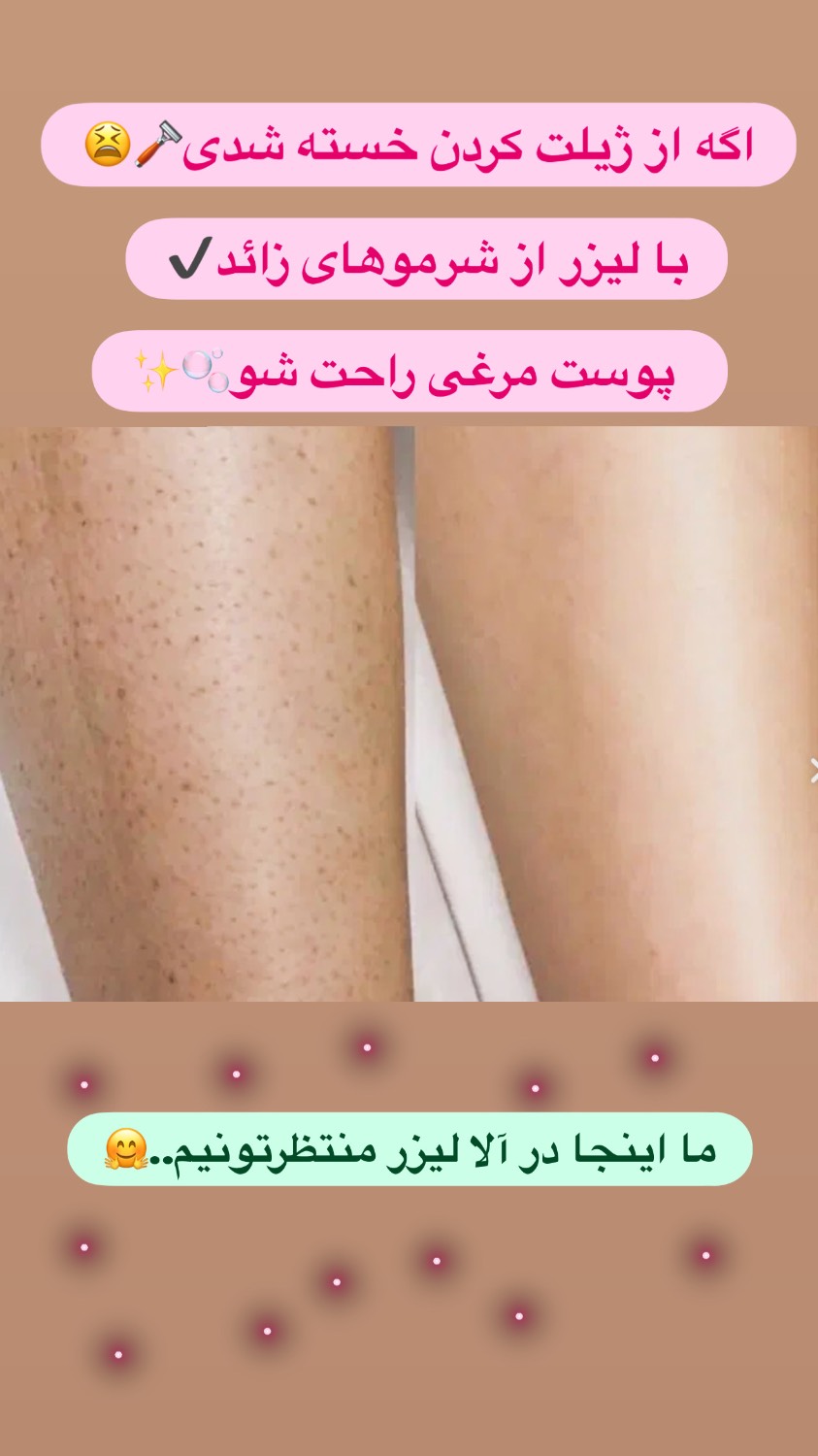 مطب پوست و مو لیزر آلا لیزر در {"id":2016,"name":"\u06a9\u0631\u062c","lat_long_center":"35.8121955,51.0073853","province_id":5,"county_id":null,"sector_id":null,"code":null,"short_code":null,"status":true,"approve":true}